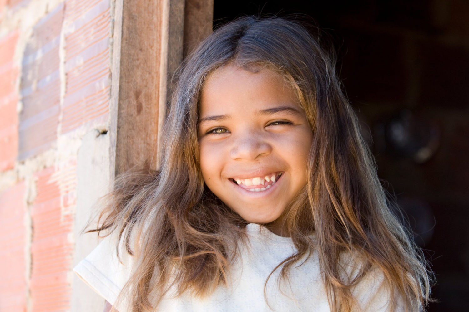 Operation Smile
